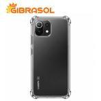 Estuche Transparente – Xiaomi Mi 11 Lite NE 5G